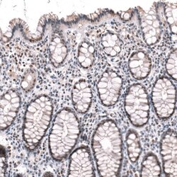 BTBD7 Antibody, Novus Biologicals:Antibodies:Primary Antibodies