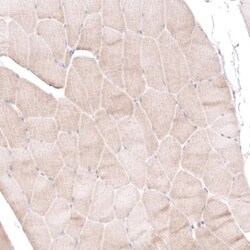 BTBD7 Antibody, Novus Biologicals:Antibodies:Primary Antibodies