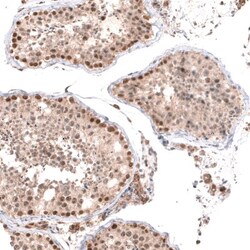 BTBD7 Antibody, Novus Biologicals:Antibodies:Primary Antibodies