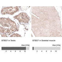 BTBD7 Antibody, Novus Biologicals:Antibodies:Primary Antibodies