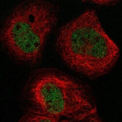 BTBD8 Antibody, Novus Biologicals:Antibodies:Primary Antibodies