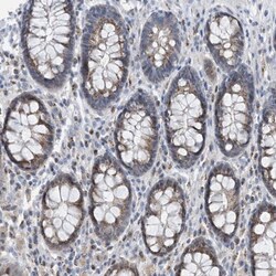 BTBD8 Antibody, Novus Biologicals 25 &mu;L, Unlabeled:Antibodies, Polyclonal
