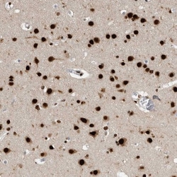 BTF Antibody, Novus Biologicals 0.1mL; Unlabeled:Antibodies, Polyclonal