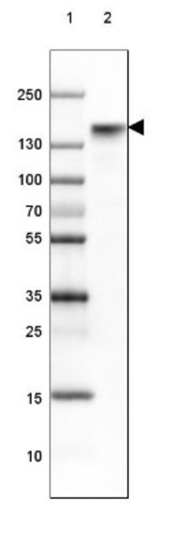 BTF Antibody, Novus Biologicals 0.1mL; Unlabeled:Antibodies, Polyclonal