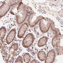BTF3L4 Antibody, Novus Biologicals 25 &mu;L, Unlabeled:Antibodies, Polyclonal