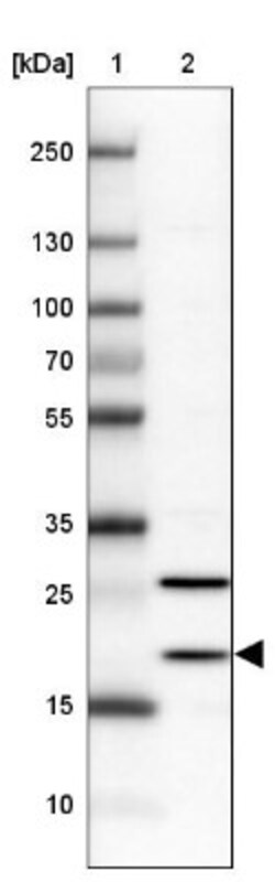 BTF3L4 Antibody, Novus Biologicals 25 &mu;L, Unlabeled:Antibodies, Polyclonal