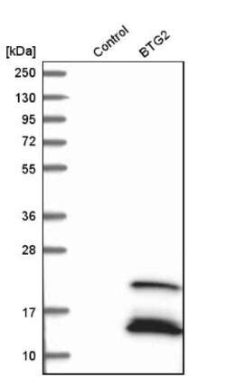 BTG2 Antibody, Novus Biologicals:Antibodies:Primary Antibodies
