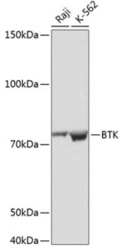 BTK Rabbit anti-Human, Mouse, Clone: 2J9O8, Novus Biologicals 100 &mu;g | Buy Online | Novus Biologicals | Fisher Scientific