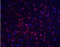 BTK Antibody - BSA Free, Novus Biologicals:Antibodies:Primary Antibodies