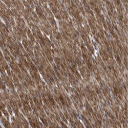 BTN2A1 Antibody, Novus Biologicals 0.1mL; Unlabeled:Antibodies, Polyclonal