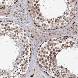 BUD13 Antibody, Novus Biologicals 0.1mL; Unlabeled:Antibodies, Polyclonal