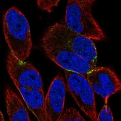BVES Antibody, Novus Biologicals 0.1mL; Unlabeled:Antibodies, Polyclonal
