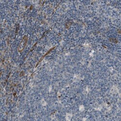 BVES Antibody, Novus Biologicals 0.1mL; Unlabeled:Antibodies, Polyclonal