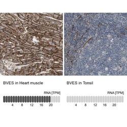 BVES Antibody, Novus Biologicals 0.1mL; Unlabeled:Antibodies, Polyclonal