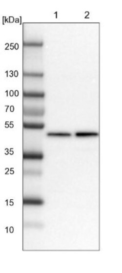 BXDC5 Antibody, Novus Biologicals 25 &mu;L; Unlabeled:Antibodies, Polyclonal