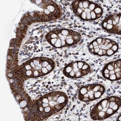 BZW2 Antibody, Novus Biologicals:Antibodies:Primary Antibodies