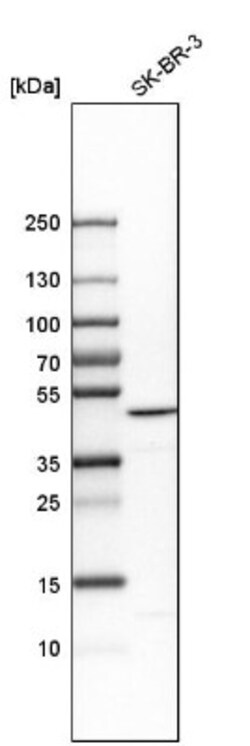 BZW2 Antibody, Novus Biologicals:Antibodies:Primary Antibodies