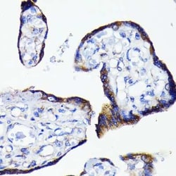 Bad Rabbit anti-Human, Mouse, Rat, Clone: 1I10A2, Novus Biologicals 100