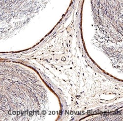 Bad Antibody, Novus Biologicals 0.025mL; Unlabeled:Antibodies, Polyclonal