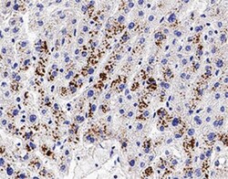 Bad Antibody, Novus Biologicals:Antibodies:Primary Antibodies