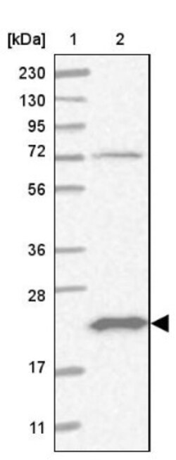 Bad Antibody, Novus Biologicals 0.1mL; Unlabeled:Antibodies, Polyclonal