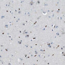 Band 3 Antibody, Novus Biologicals 0.1mL; Unlabeled:Antibodies, Polyclonal