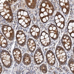 Bax Antibody, Novus Biologicals 25 &mu;L; Unlabeled:Antibodies, Polyclonal