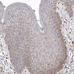 Bax Antibody, Novus Biologicals 25 &mu;L; Unlabeled:Antibodies, Polyclonal