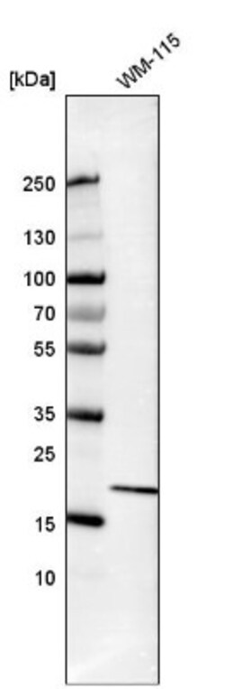 Bax Antibody, Novus Biologicals 25 &mu;L; Unlabeled:Antibodies, Polyclonal
