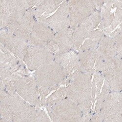 Bax Antibody, Novus Biologicals 25 &mu;L; Unlabeled:Antibodies, Polyclonal
