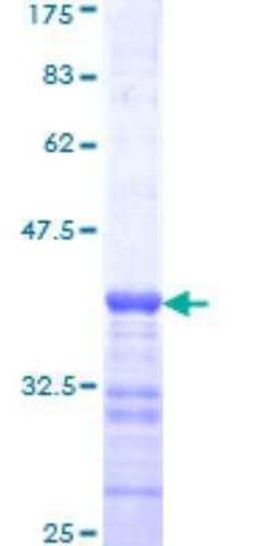 Novus Biologicals Recombinant Human Bax GST (N-Term) Protein 25 &mu;g | Buy Online | Novus Biologicals&trade; | Fisher Scientific