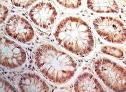 Bax inhibitor 1 Antibody (20F430) - Azide Free, Novus Biologicals 0.1mg;