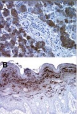 Bax inhibitor 1 Antibody (20F430), Novus Biologicals 0.1mg; Unlabeled:Antibodies,