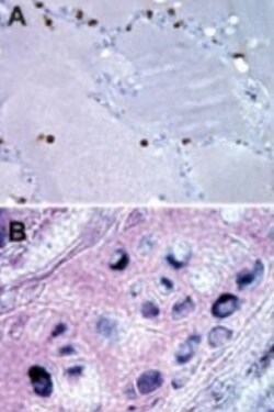 Bax inhibitor 1 Antibody (20F430), Novus Biologicals 0.1mg; Unlabeled:Antibodies,