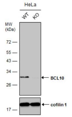 Bcl-10 Antibody, Novus Biologicals 0.1mL; Unlabeled:Antibodies, Polyclonal