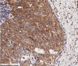 Bcl-2 Antibody, Novus Biologicals:Antibodies:Primary Antibodies