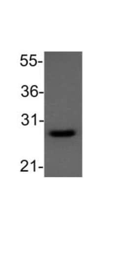 Bcl-2 Antibody, Novus Biologicals:Antibodies:Primary Antibodies