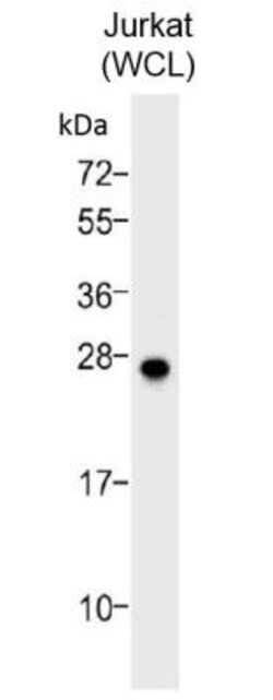 Bcl-2 Antibody, Novus Biologicals:Antibodies:Primary Antibodies
