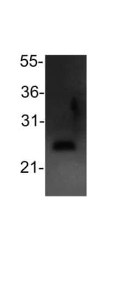 Bcl-2 Antibody, Novus Biologicals:Antibodies:Primary Antibodies