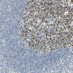 Bcl-6 Antibody, Novus Biologicals:Antibodies:Primary Antibodies