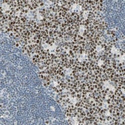 Bcl-6 Antibody, Novus Biologicals:Antibodies:Primary Antibodies