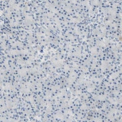 Bcl-6 Antibody, Novus Biologicals:Antibodies:Primary Antibodies