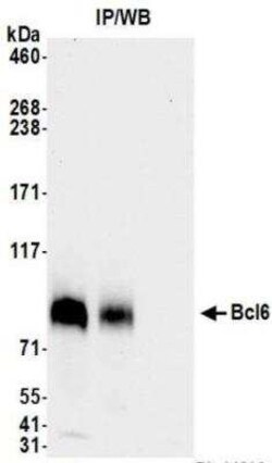 Bcl-6 Antibody (BLR143H), Novus Biologicals 100 &mu;g | Buy Online | Novus Biologicals | Fisher Scientific