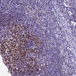 Bcl 7A Antibody, Novus Biologicals 25 &mu;L; Unlabeled:Antibodies, Polyclonal