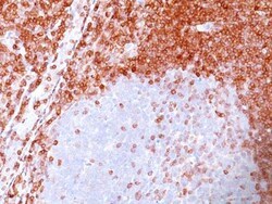 Bcl-2 Antibody (100/D5), Novus Biologicals 0.2mg; Unlabeled:Antibodies,