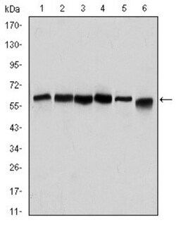 anti-Beclin 1/ATG6, Clone: 2A4, Novus Biologicals 0.1mL; Unlabeled, Quantity: