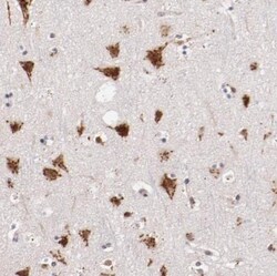 Begain Antibody, Novus Biologicals 25 &mu;L; Unlabeled:Antibodies, Polyclonal