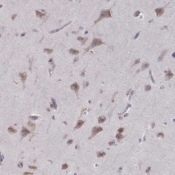 Bend6 Antibody, Novus Biologicals 0.1mL; Unlabeled:Antibodies, Polyclonal