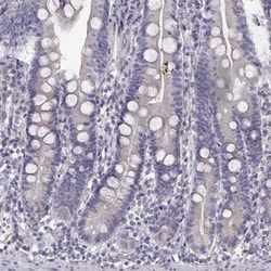 Bend6 Antibody, Novus Biologicals 0.1mL; Unlabeled:Antibodies, Polyclonal