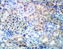 Bestrophin 3 Antibody, Novus Biologicals 100 &mu;g | Buy Online | Novus Biologicals | Fisher Scientific